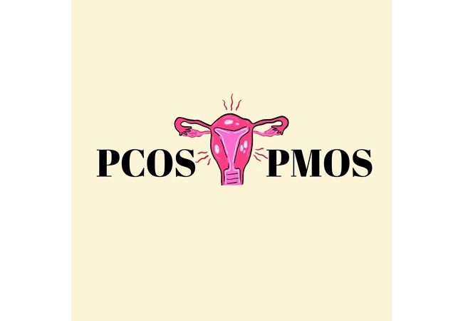PCOS TARİHE KARIŞTI: PMOS NEDİR, NEDEN İSMİ DEĞİŞTİ?